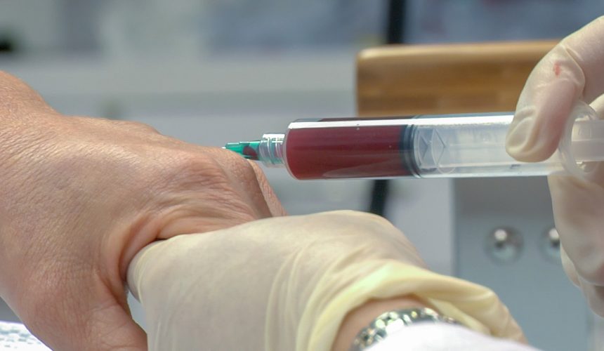 PRP TERAPIJA: VLASTITOM KRVLJU PROTIV BOLOVA U ZGLOBOVIMA PRP TERAPIJA: VLASTITOM KRVLJU PROTIV BOLOVA U ZGLOBOVIMA